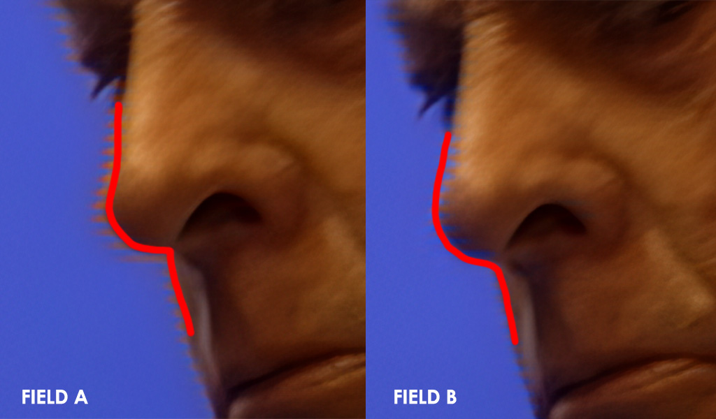 Image with the edge of the subject highlighted showing the difference in combing between field A and field B.